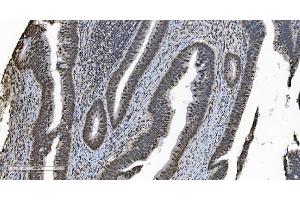 IHC analysis of HNRNPH3 using anti-HNRNPH3 antibody (ABIN7601121).