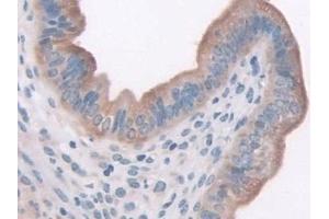 Detection of LEPR in Mouse Uterus Tissue using Polyclonal Antibody to Leptin Receptor (LEPR) (Leptin Receptor 抗体  (AA 22-203))
