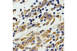 Immunohistochemical analysis of Chitotriosidase staining in human stomach formalin fixed paraffin embedded tissue section. (Chitotriosidase 1 抗体)