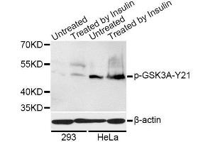 Western blot analysis of extracts of 293 and HeLa cells, using Phospho-GSK3A-S21 antibody. (GSK3 alpha 抗体  (pSer21))