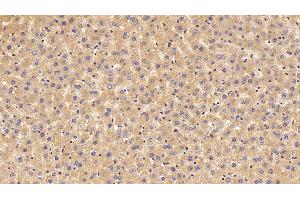 Detection of PALB in Rat Liver Tissue using Polyclonal Antibody to Prealbumin (PALB) (TTR 抗体  (AA 20-147))