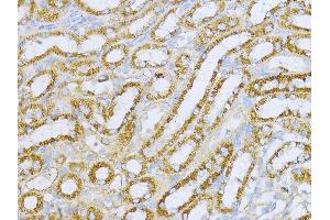 Immunohistochemistry (IHC) image for anti-Aconitase 2, Mitochondrial (ACO2) (AA 501-780) antibody (ABIN1678537)