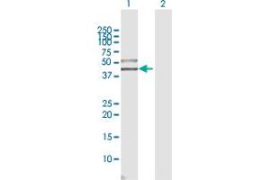 Western Blot analysis of SIGIRR expression in transfected 293T cell line by SIGIRR MaxPab polyclonal antibody. (SIGIRR 抗体  (AA 1-410))