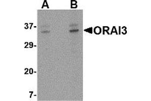 Western Blotting (WB) image for anti-ORAI Calcium Release-Activated Calcium Modulator 3 (ORAI3) (C-Term) antibody (ABIN1030564) (ORAI3 抗体  (C-Term))