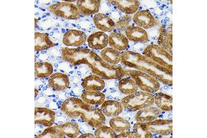 Immunohistochemistry of paraffin-embedded mouse kidney using NQO1 antibody (ABIN7268795) at dilution of 1:100 (40x lens). (NQO1 抗体)