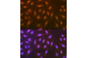 Immunofluorescence analysis of U-2 OS cells using Syntenin Rabbit mAb (ABIN7270680) at dilution of 1:100 (40x lens). (SDCBP 抗体)