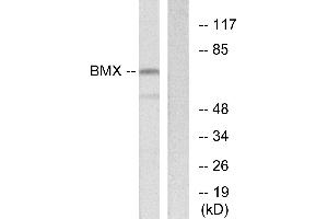 Immunohistochemistry analysis of paraffin-embedded human thyroid gland tissue using BMX antibody.