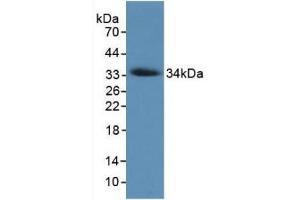 Detection of Recombinant COL7, Human using Monoclonal Antibody to Collagen Type VII (COL7) (COL7 抗体  (AA 190-472))