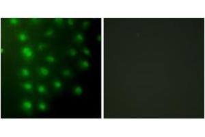 Immunofluorescence analysis of HuvEc cells, using AKAP8 Antibody. (AKAP8 抗体  (AA 331-380))