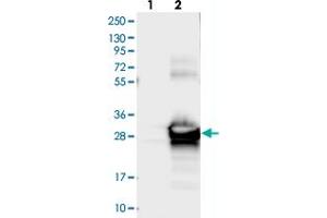 Western blot analysis of Lane 1: Negative control (vector only transfected HEK293T lysate), Lane 2: Over-expression Lysate (Co-expressed with a C-terminal myc-DDK tag (~3. (SIKE1 抗体)