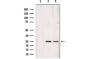 Western blot analysis of extracts from various samples, using PLDN antibody. (Pallidin 抗体  (C-Term))