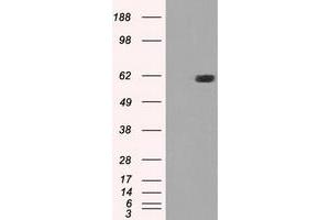 HEK293T cells were transfected with the pCMV6-ENTRY control (Left lane) or pCMV6-ENTRY STK39 (Right lane) cDNA for 48 hrs and lysed. (STK39 抗体)