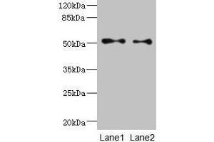 Western blot All lanes: TUBB3 antibody at 6 μg/mL Lane 1: A549 whole cell lysate Lane 2: A431 whole cell lysate Secondary Goat polyclonal to rabbit IgG at 1/10000 dilution Predicted band size: 51, 43 kDa Observed band size: 51 kDa (TUBB3 抗体  (AA 1-210))