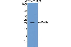 Western blot analysis of the recombinant protein. (FTH1 抗体  (AA 1-182))