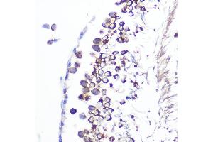 Immunohistochemistry of paraffin-embedded rat testis using J/CSN5/COPS5 Rabbit mAb (ABIN7266497) at dilution of 1:100 (40x lens). (COPS5 抗体)