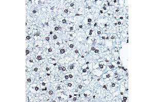 Immunohistochemistry of paraffin-embedded mouse liver using K Rabbit pAb (ABIN6128005, ABIN6142689, ABIN6142690 and ABIN6221516) at dilution of 1:100 (40x lens). (MYST2 抗体  (AA 55-193))