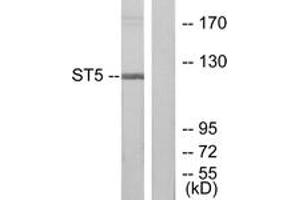 Western blot analysis of extracts from COLO205 cells, using ST5 Antibody. (ST5 抗体  (AA 411-460))