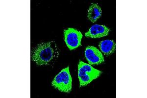 Confocal immunofluorescent analysis of Y Antibody (C-term) (ABIN655601 and ABIN2845085) with NCI- cell followed by Alexa Fluor 488-conjugated goat anti-rabbit lgG (green). (YI016 (AA 253-280), (C-Term) 抗体)