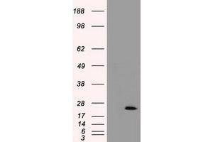HEK293T cells were transfected with the pCMV6-ENTRY control (Left lane) or pCMV6-ENTRY TNNI3 (Right lane) cDNA for 48 hrs and lysed. (TNNI3 抗体)