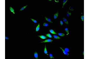 Immunofluorescent analysis of Hela cells using ABIN7168220 at dilution of 1:100 and Alexa Fluor 488-congugated AffiniPure Goat Anti-Rabbit IgG(H+L) (NQO2 抗体  (AA 1-231))