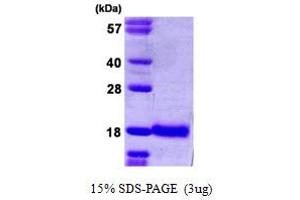 SDS-PAGE (SDS) image for Ubiquitin-Conjugating Enzyme E2D 1 (UBE2D1) (AA 1-147) protein (His tag) (ABIN667460) (UBE2D1 Protein (AA 1-147) (His tag))