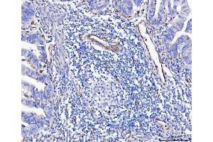 IHC analysis of CD93 using anti-CD93 antibody (ABIN7602865).