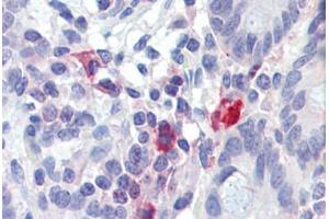 Small intestine, Human: Formalin-Fixed, Paraffin-Embedded (FFPE) (TNFAIP3 抗体)