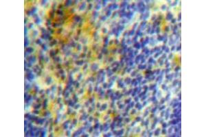 Used in DAB staining on fromalin fixed paraffin-embedded Spleen tissue (PLA2G7 抗体  (AA 22-444))