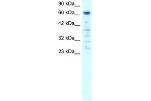 PARP3 antibody used at 1-2 ug/ml to detect target protein. (PARP3 抗体)