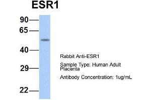 Host:  Rabbit  Target Name:  ESR1  Sample Type:  Human Adult Placenta  Antibody Dilution:  1. (Estrogen Receptor alpha 抗体  (Middle Region))