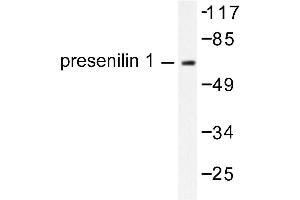 Image no. 1 for anti-Presenilin 1 (PSEN1) antibody (ABIN271789) (Presenilin 1 抗体)