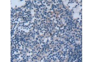#VALUE! (Signaling Lymphocytic Activation Molecule Family, Member 2 (AA 23-217) 抗体)