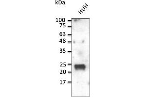Western Blotting (WB) image for anti-RAB1A, Member RAS Oncogene Family (RAB1A) (C-Term) antibody (ABIN7272978) (RAB1A 抗体  (C-Term))