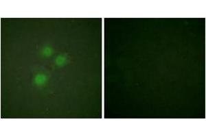 Immunofluorescence (IF) image for anti-MKI67 FHA Domain-Interacting Nucleolar Phosphoprotein (MKI67IP) (AA 200-249) antibody (ABIN2888898) (NIFK 抗体  (AA 200-249))