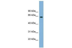 SLFN12 antibody used at 1 ug/ml to detect target protein. (SLFN12 抗体  (Middle Region))