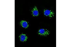 Confocal immunofluorescent analysis of MUSK Antibody (ABIN392021 and ABIN2841797) with MDA-M cell followed by Alexa Fluor 488-conjugated goat anti-rabbit lgG (green). (MUSK 抗体)