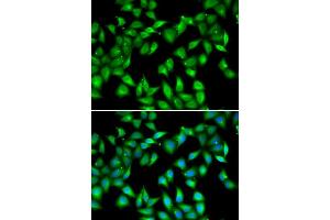 Immunofluorescence analysis of U2OS cells using MYL3 antibody (ABIN6133198, ABIN6144249, ABIN6144250 and ABIN6222363). (MYL3/CMLC1 抗体  (AA 1-195))