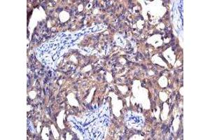 NME1 antibody was used for immunohistochemistry at a concentration of 4-8 ug/ml. (NME1 抗体  (N-Term))