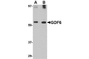 Western blot analysis of GDF6 in SK-N-SH lysate with AP30360PU-N GDF6 antibody at (A) 0. (GDF6 抗体  (C-Term))