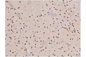 Immunohistochemistry (IHC) image for anti-Signal Transducer and Activator of Transcription 3 (Acute-Phase Response Factor) (STAT3) (pSer727) antibody (ABIN6256411)