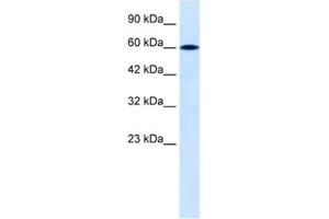 Western Blotting (WB) image for anti-Dachshund 2 (DACH2) antibody (ABIN2460463) (DACH2 抗体)