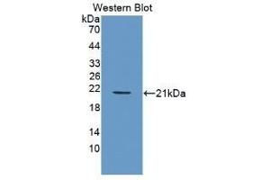 Detection of Recombinant PDGFBB, Human using Monoclonal Antibody to Platelet Derived Growth Factor BB (PDGF BB) (PDGF-BB Homodimer (AA 82-190) 抗体)