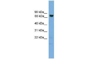 WB Suggested Anti-GCLC Antibody Titration: 0. (GCLC 抗体  (Middle Region))