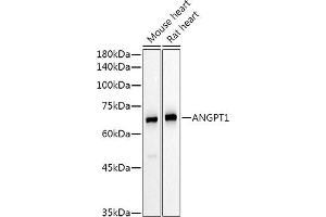 Western blot analysis of extracts of various cell lines, using  Rabbit pAb antibody (ABIN6127432, ABIN6136873, ABIN6136875 and ABIN6223859) at 1:500 dilution. (Angiopoietin 1 抗体  (AA 260-400))