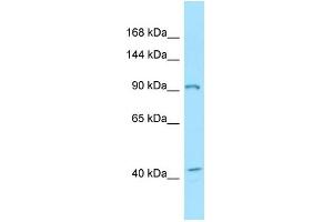 WB Suggested Anti-EPHB3 Antibody Titration: 1. (EPH Receptor B3 抗体  (C-Term))