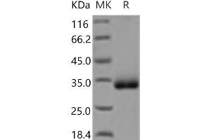 Western Blotting (WB) image for Chondrolectin (CHODL) protein (His tag) (ABIN7321093) (CHODL Protein (His tag))