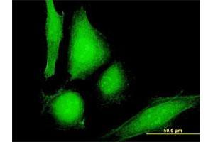 Immunofluorescence of purified MaxPab antibody to COP1 on HeLa cell. (CARD16 抗体  (AA 1-97))