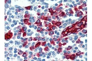 Immunohistochemistry (IHC) image for anti-Selectin P Ligand (SELPLG) antibody (ABIN614543) (SELPLG 抗体)