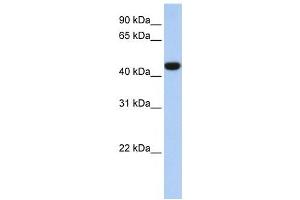 IDH1 antibody used at 1 ug/ml to detect target protein. (IDH1 抗体)