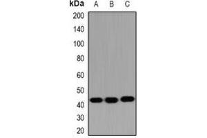 Western blot analysis of HSD17B2 expression in SW480 (A), mouse liver (B), mouse kidney (C) whole cell lysates. (HSD17B2 抗体)